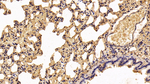 S100A10 Antibody in Immunohistochemistry (Paraffin) (IHC (P))