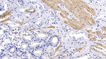 alpha-Cardiac Actin Antibody in Immunohistochemistry (Paraffin) (IHC (P))