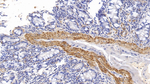 alpha-Cardiac Actin Antibody in Immunohistochemistry (Paraffin) (IHC (P))