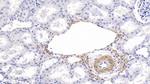 alpha-Cardiac Actin Antibody in Immunohistochemistry (Paraffin) (IHC (P))