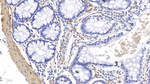 alpha-Cardiac Actin Antibody in Immunohistochemistry (Paraffin) (IHC (P))