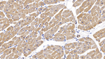 alpha-Cardiac Actin Antibody in Immunohistochemistry (Paraffin) (IHC (P))