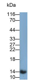 Cystatin B Antibody in Western Blot (WB)
