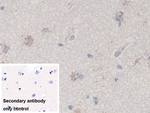 TGF beta-3 Monoclonal Antibody (C3)