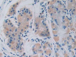 GHRH Monoclonal Antibody (C2)