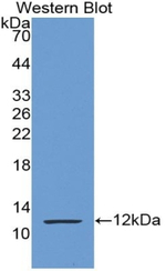 S100P Antibody in Western Blot (WB)