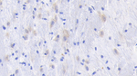 NGF Antibody in Immunohistochemistry (Paraffin) (IHC (P))