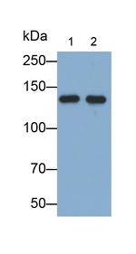 RBP3 Antibody in Western Blot (WB)