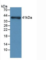 Nephrin Antibody in Western Blot (WB)
