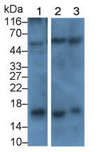 CRF Monoclonal Antibody (E1)