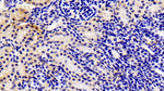 MMP13 Antibody in Immunohistochemistry (Paraffin) (IHC (P))