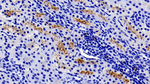 GGT1 Monoclonal Antibody (C1)
