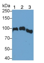 Angiostatin Antibody in Western Blot (WB)