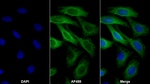 beta Tubulin Antibody in Immunocytochemistry (ICC/IF)