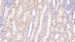 LUM Monoclonal Antibody (C4)