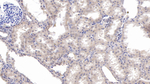 KPNA2 Antibody in Immunohistochemistry (Paraffin) (IHC (P))