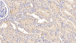 EB1 Antibody in Immunohistochemistry (Paraffin) (IHC (P))