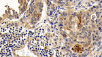 BCL-XL Antibody in Immunohistochemistry (Paraffin) (IHC (P))