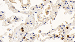 BCL-XL Antibody in Immunohistochemistry (Paraffin) (IHC (P))