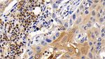 BCL-XL Antibody in Immunohistochemistry (Paraffin) (IHC (P))