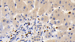 BCL-XL Antibody in Immunohistochemistry (Paraffin) (IHC (P))