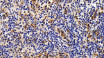 BCL-XL Antibody in Immunohistochemistry (Paraffin) (IHC (P))
