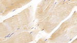 CD90 Antibody in Immunohistochemistry (Paraffin) (IHC (P))