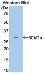 ANGPTL4 Antibody in Western Blot (WB)