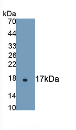AHSP Antibody in Western Blot (WB)