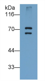 PADI6 Antibody in Western Blot (WB)