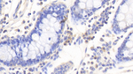 IL-12 p40 Antibody in Immunohistochemistry (Paraffin) (IHC (P))
