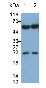 IL-15 Antibody in Western Blot (WB)