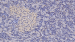IL1RA Monoclonal Antibody (C3)