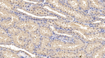 IL1RA Antibody in Immunohistochemistry (Paraffin) (IHC (P))