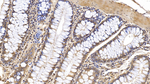 IL1RA Antibody in Immunohistochemistry (Paraffin) (IHC (P))
