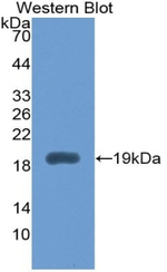 IL1RA Antibody in Western Blot (WB)