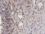 EGR1 Antibody in Immunohistochemistry (Paraffin) (IHC (P))