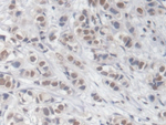 EGR1 Antibody in Immunohistochemistry (Paraffin) (IHC (P))
