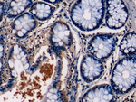 PKC epsilon Antibody in Immunohistochemistry (Paraffin) (IHC (P))