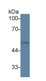 PKC epsilon Antibody in Western Blot (WB)