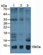 S100A6 Antibody in Western Blot (WB)
