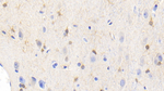 Creatine Kinase BB Antibody in Immunohistochemistry (Paraffin) (IHC (P))