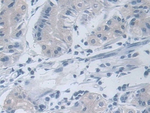 RANK Antibody in Immunohistochemistry (Paraffin) (IHC (P))