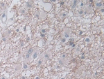 RANK Antibody in Immunohistochemistry (Paraffin) (IHC (P))