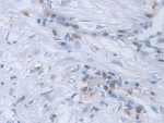 RANK Monoclonal Antibody (D13)