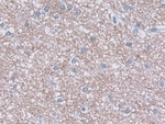 RANK Antibody in Immunohistochemistry (Paraffin) (IHC (P))