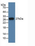 FGF21 Antibody in Western Blot (WB)