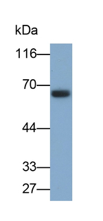 GCKR Antibody in Western Blot (WB)