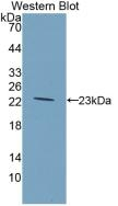 GCKR Antibody in Western Blot (WB)