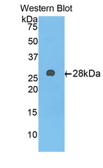 A1BG Antibody in Western Blot (WB)